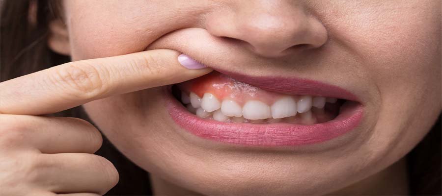 Treating Teeth Disease