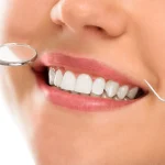 dental-care1